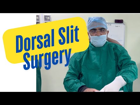 How to do Dorsal Slit Surgery for Phimosis(skin saving surgery ) by Dr.Sachin Kuber+919832136136