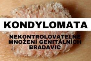 kondylomata