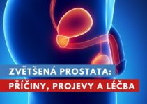 zvětšená prostata