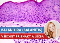 balanitida, balanitis