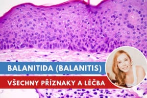 balanitida, balanitis