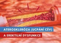 ateroskleróza a erektilní dysfunkce