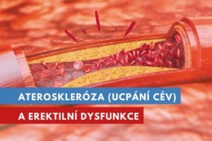 ateroskleróza a erektilní dysfunkce