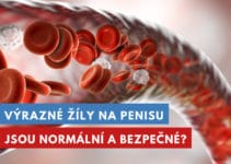 výrazné žíly na penisu
