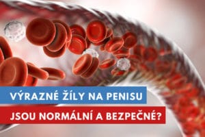 výrazné žíly na penisu