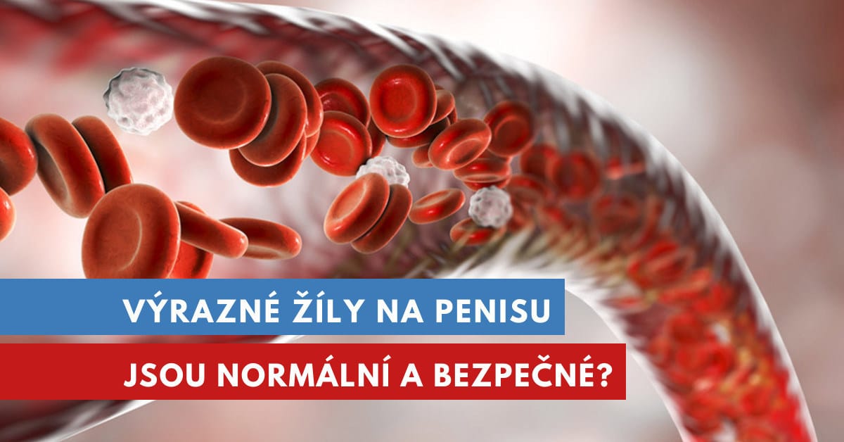 výrazné žíly na penisu