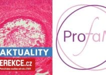 operace pro oddálení menopauzy