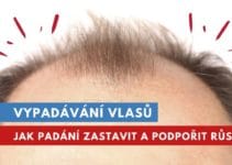 vypadávání vlasů