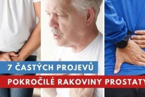 rakovina prostaty příznaky