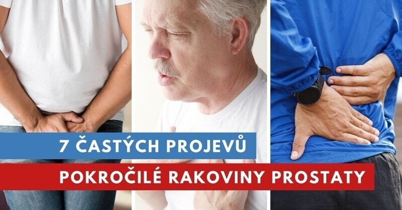 rakovina prostaty příznaky