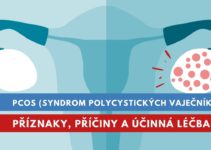 PCOS, syndrom polycystických ovarií (vaječníků)