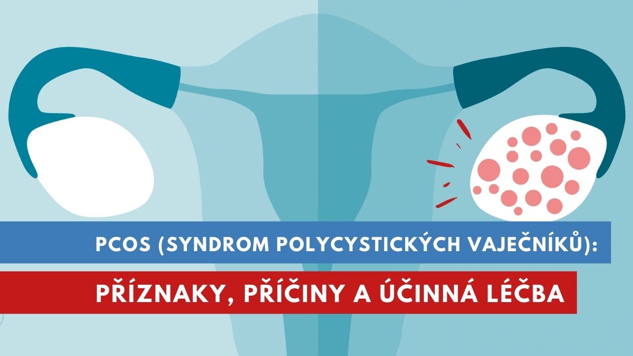 PCOS, syndrom polycystických ovarií (vaječníků)