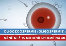 oligozoospermie, oligospermie