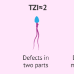 teratospermie, možnosti poruch