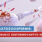 teratozoospermia