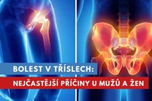 bolest v tříslech u mužů a žen