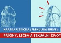 krátká uzdička, frenulum breve