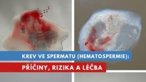 krev ve spermatu, krev v ejakulátu, hematospermie