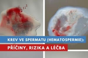 krev ve spermatu, krev v ejakulátu, hematospermie