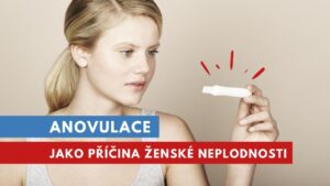 anovulace