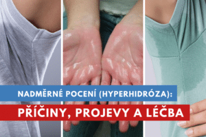 nadměrné pocení, hyperhidróza