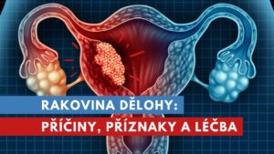 rakovina dělohy