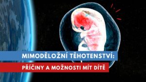 mimoděložní těhotenství