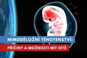 mimoděložní těhotenství