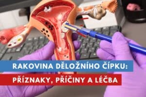 rakovina děložního čípku
