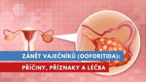 zánět vaječníků