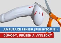 amputace penisu, uříznutí penisu. penektomie