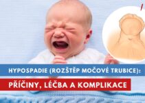 hypospadie