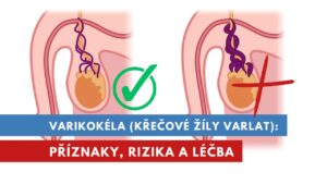 varikokéla, křečové žíly na varlatech