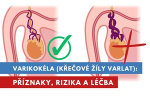varikokéla, křečové žíly na varlatech