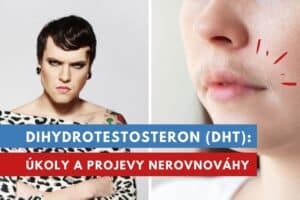 dihydrotestosteron
