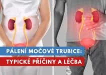 pálení močové trubice