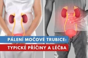 pálení močové trubice