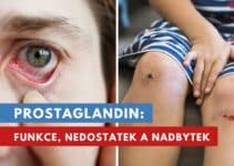 prostaglandin