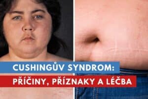 Cushingův syndrom