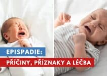 epispadie