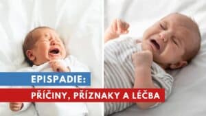 epispadie