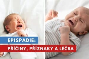 epispadie