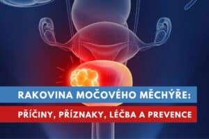 rakovina močového měchýře