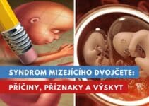 syndrom mizejícího dvojčete