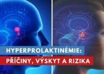 hyperprolaktinémie
