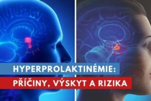 hyperprolaktinémie