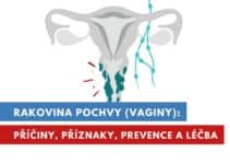 rakovina pochvy