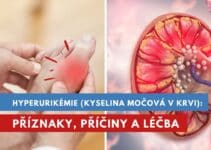 hyerurikémie, kyselina močová v krvi