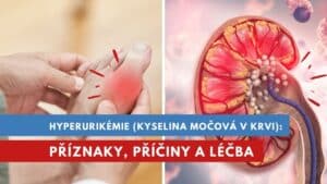 hyerurikémie, kyselina močová v krvi