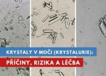 krystaly v moči